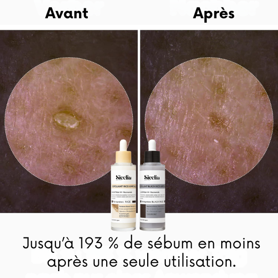 Sicelia™ Shots Éclat & Pureté
