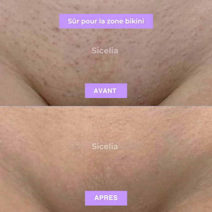 Sicelia™ Huile Anti-Poils