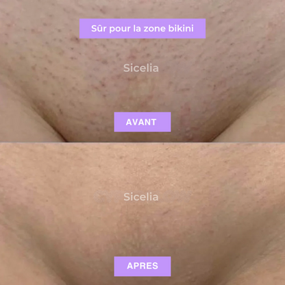 Sicelia™ Huile Anti-Poils