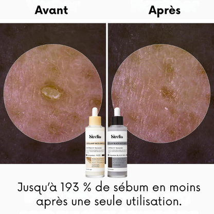 Sicelia™ Shots Éclat & Pureté