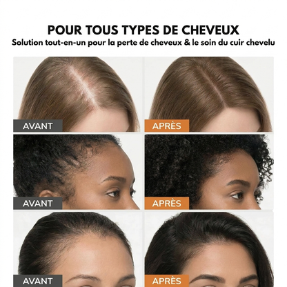 Scalp Sérum repousse et anti-chute (adapté aux cheveux fins)