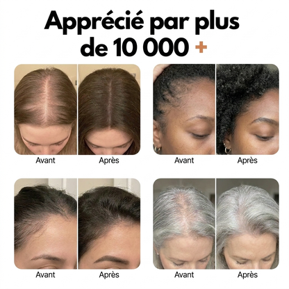 Scalp Sérum repousse et anti-chute (adapté aux cheveux fins)