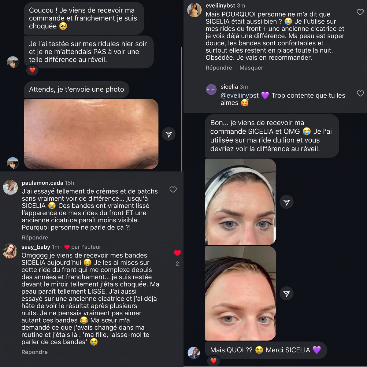 SICELIA™ Bandes Collagène Lissantes de Nuit – Rides & Ridules.