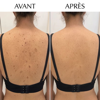 La peau lisse dont vous rêvez, en seulement 7 jours.