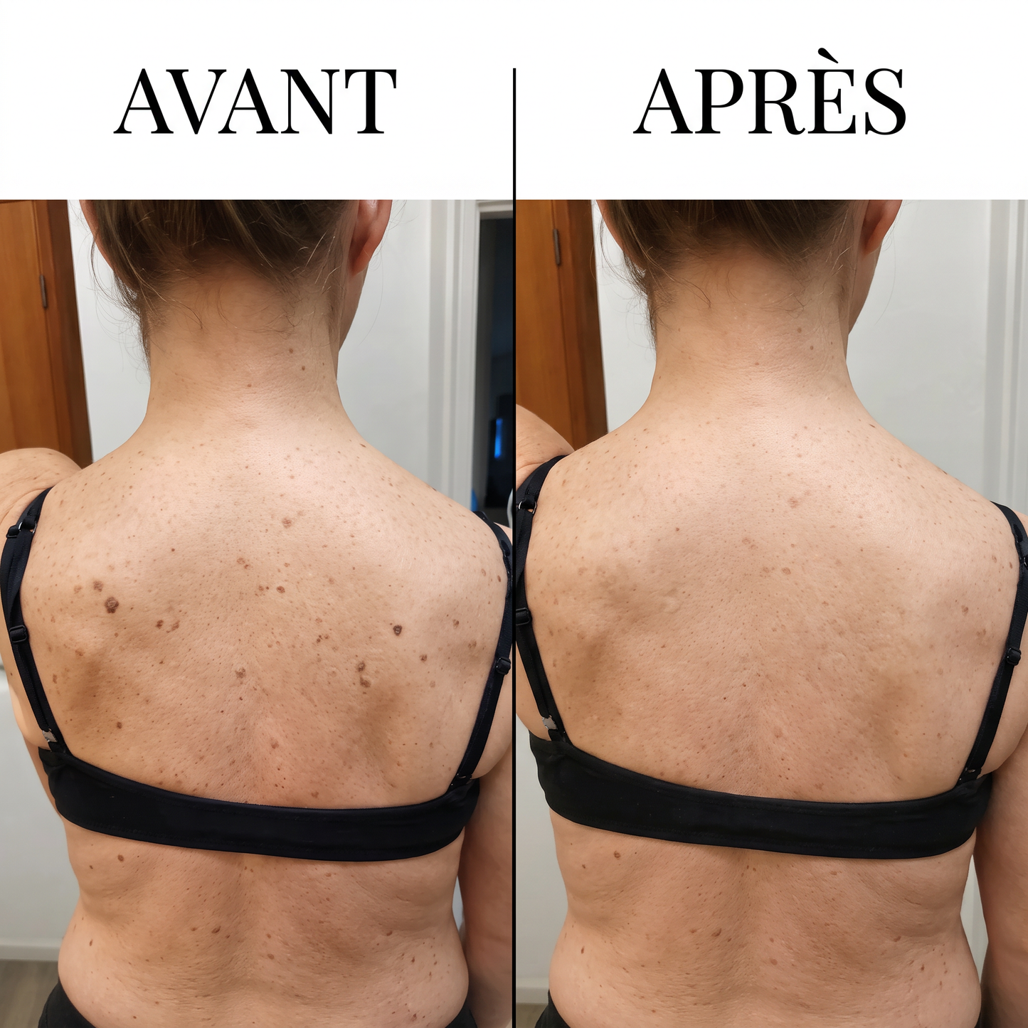 La peau lisse dont vous rêvez, en seulement 7 jours.