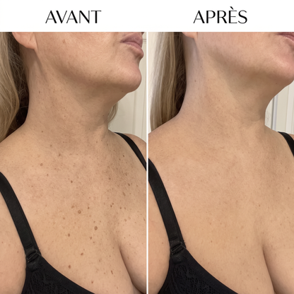 La peau lisse dont vous rêvez, en seulement 7 jours.
