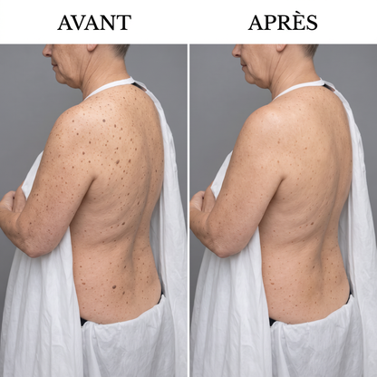 La peau lisse dont vous rêvez, en seulement 7 jours.