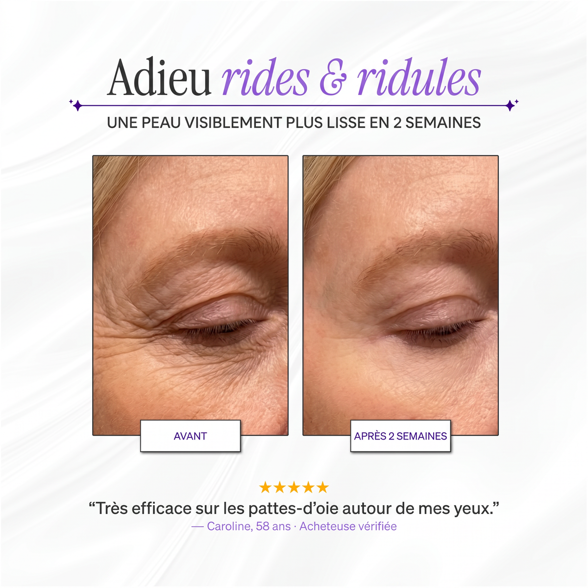 SICELIA™ Bandes Collagène Lissantes de Nuit – Rides & Ridules.