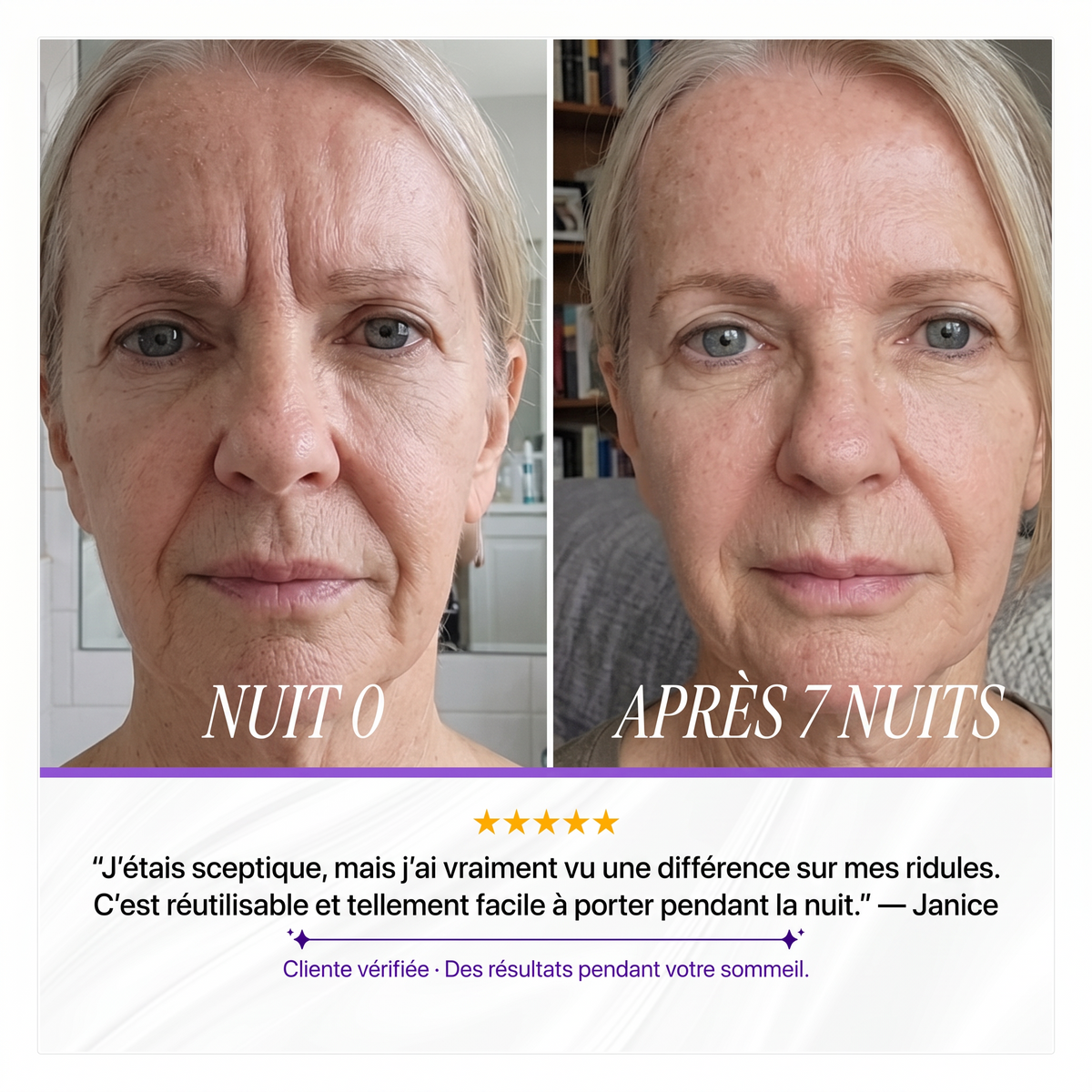 SICELIA™ Bandes Collagène Lissantes de Nuit – Rides & Ridules.
