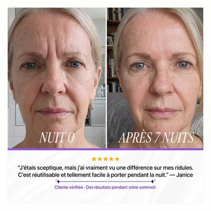 SICELIA™ Bandes Collagène Lissantes de Nuit – Rides & Ridules.